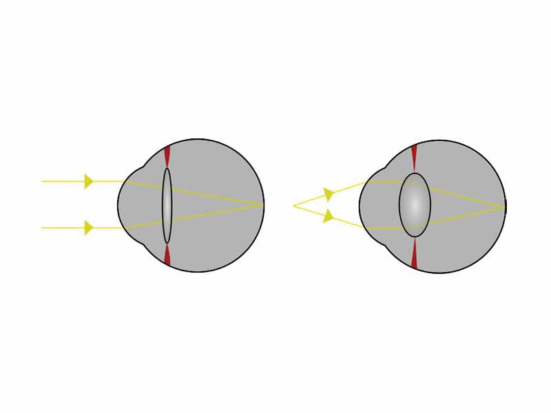 Light from a single point of a distant object and light from a single point of a near object being brought to a focus by changing the curvature of the lens.