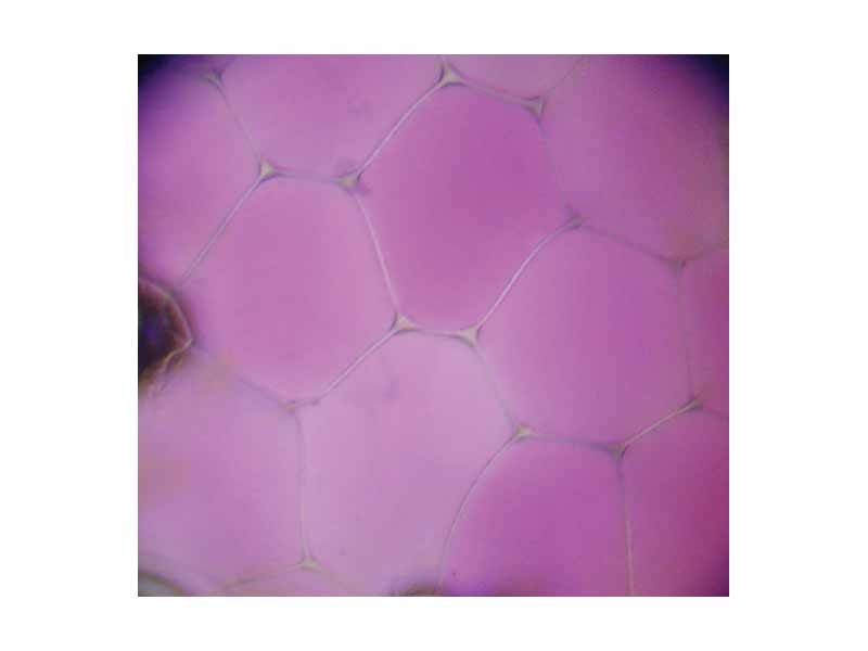 The vacuole of Rhoeo discolor - unshrunk