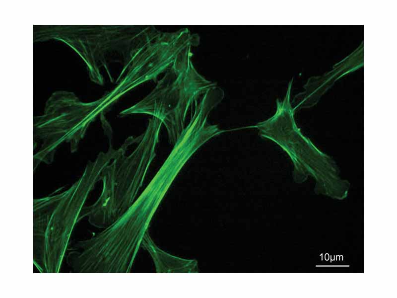 Actin cytoskeleton of mouse embryo fibroblasts, stained with phalloidin
