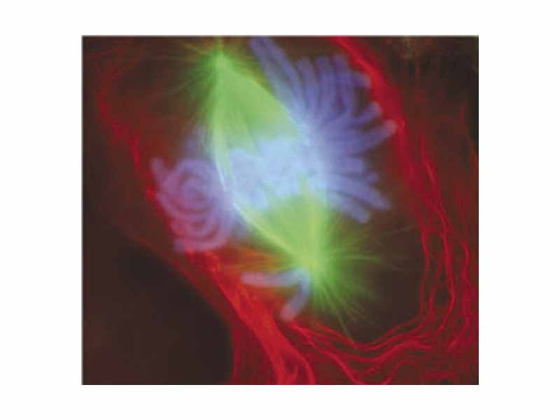A cell in late metaphase. All chromosomes (blue) but one have arrived at the metaphase plate.