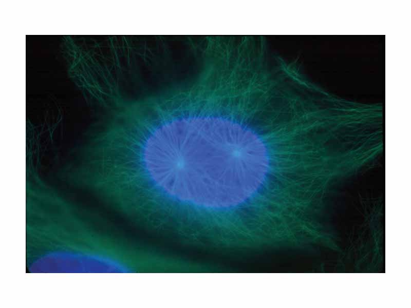 Early prophase: Nonkinetochore microtubules, shown as green strands, have established a matrix around the degrading nucleus, in blue. The green nodules are the centrosomes.