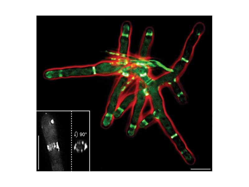 Septins in Ashbya gossypii (fluorescent micrograph) - Green: septins (AgSEP7-GFP) - Red: cell outline (phase contrast) - Inlay: 3D reconstruction of a discontinuous septin ring - Scale bars: 10 ?m