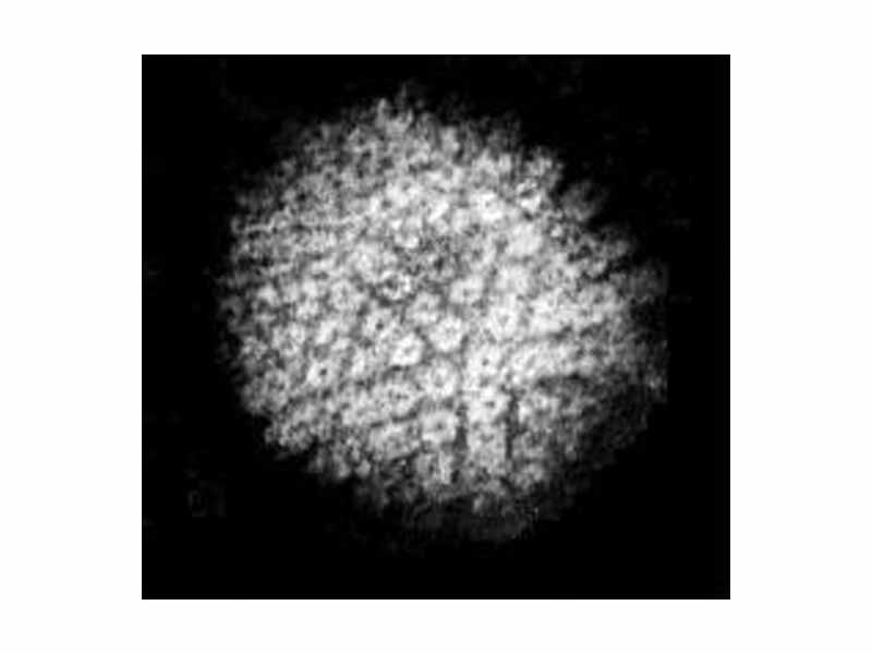 Microscopy image of a herpes virus.