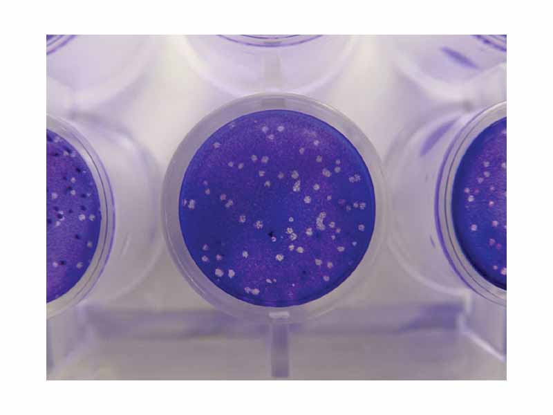 Viral Plaque Assay