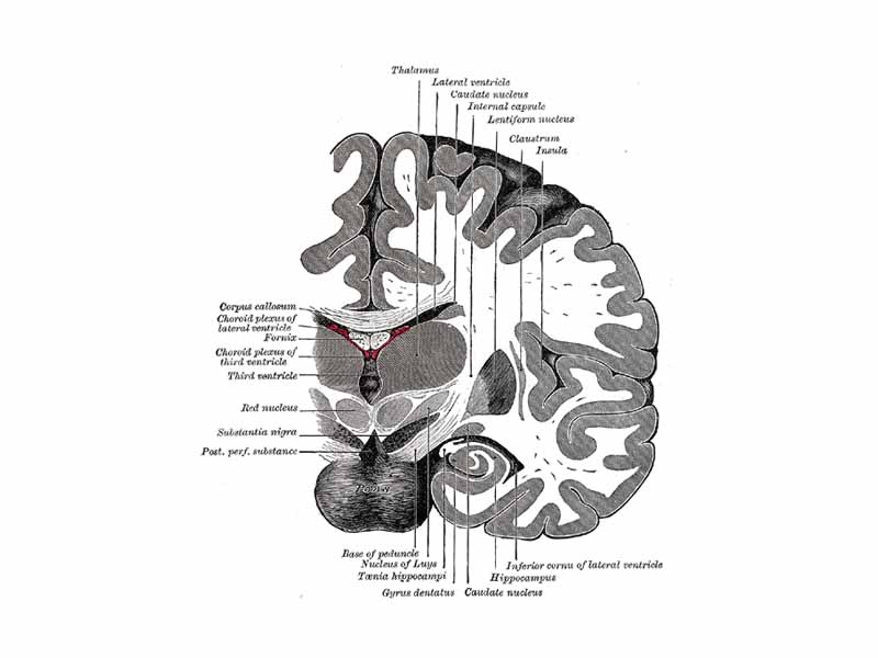 Coronal section of brain immediately in front of pons.