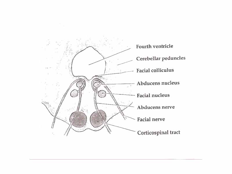 Axial section of the Brainstem (Pons) at the level of the Facial Colliculus