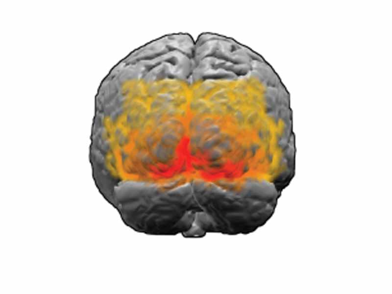 Visual cortex: V1, V2, V3, V4, V5 (also called MT)