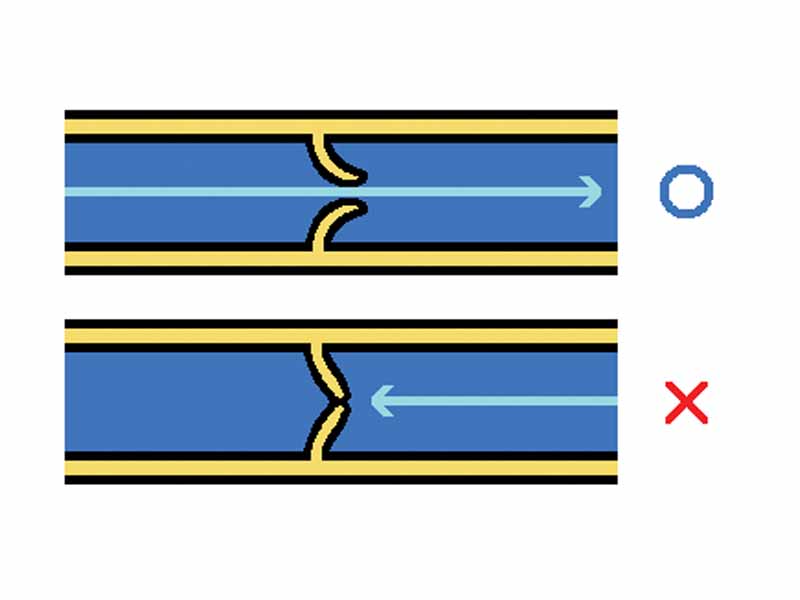 Venous valves prevent reverse blood flow.