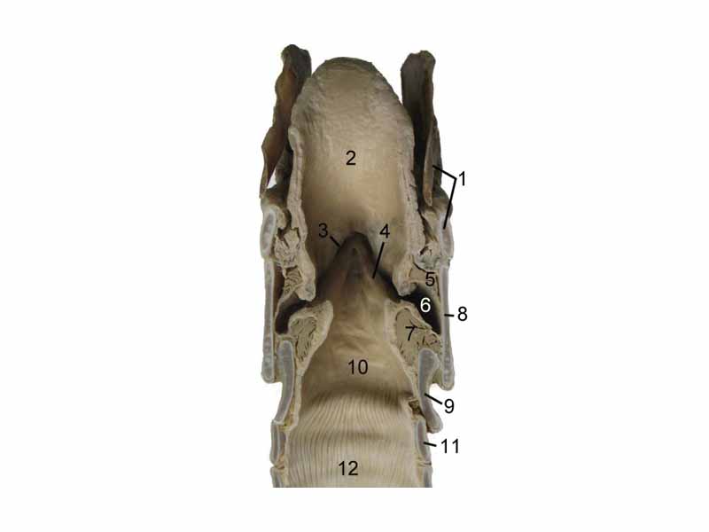 1 hyoid bone  -  2 epiglottis  -  3 vestibular fold  -  4 vocal fold  -  5 Ventricularis muscle  -  6 ventricle of larynx  -  7 Vocalis muscle  -  8 Adam's apple  -  9 rings of cartilage  -  10 infraglottic cavity  -  11 first bronchial tube cartilage  -  12 bronchial tube  