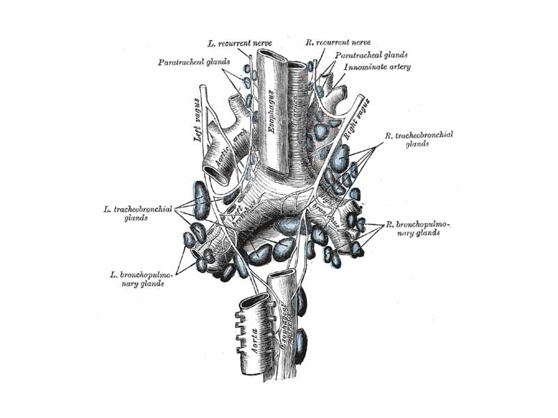 The tracheobronchial lymph glands.