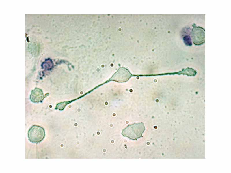 A macrophage of a mouse stretching its arms to engulf two particles, possibly pathogens