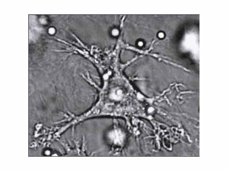 A dendritic cell