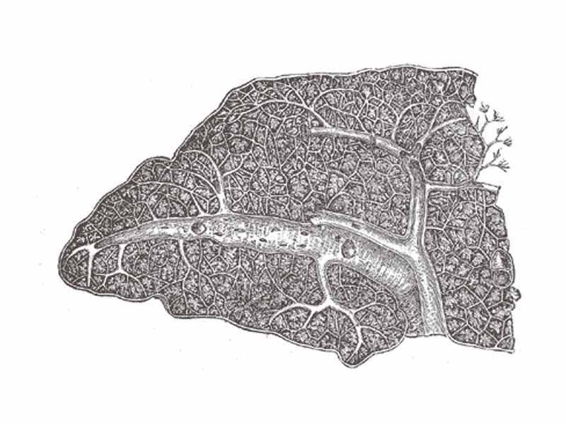 Transverse section of the human spleen, showing the distribution of the splenic artery and its branches.