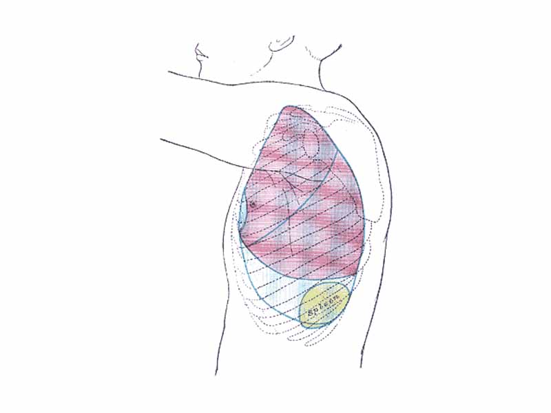 Side of thorax, showing surface markings for bones, lungs (purple), pleura (blue), and spleen (green).