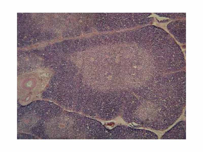 Histology of the thymus showing the cortex and medulla