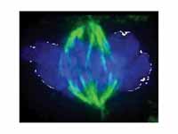 Chromosomes (blue) and mitotic spindl...