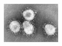 Electron micrograph of icosahedral vi...