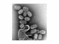 Micrograph of influenza virus