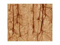 SMI32-stained pyramidal neurons in ce...