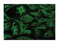 Astrocytes can be visualized in cultu...