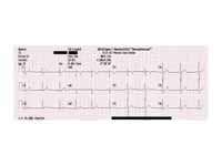 12 Lead ECG of a 26 year old male.