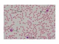Human blood smear:  a - erythrocytes;...