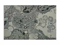 Alveolar type II cell