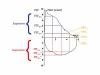 Flow-Volume loop showing successful F...