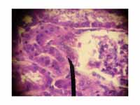 Juxtaglomerular cells