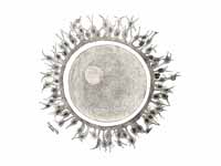 Human ovum. The zona pellucida is see...